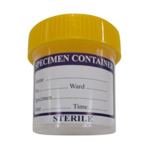 Urine Container